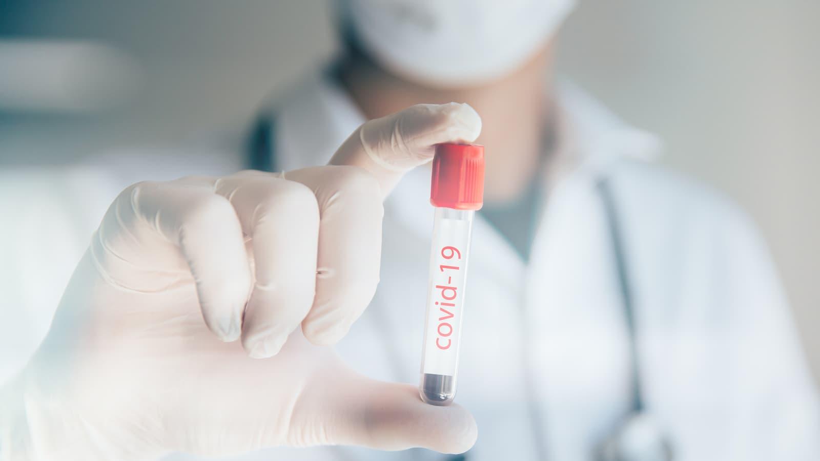 COVID-19: MoPH announces 140 new cases and 188 new recoveries